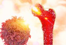 How is a bone marrow transplant performed?