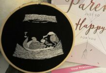 A blind future dad was able to 'see' his baby's first ultrasound thanks to an embroidery