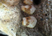 Australopithecus sediba lived in forests, eating fruit and bark