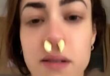 Doctors warn of putting garlic to unclog the nostrils
