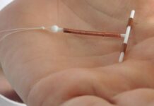 Removing the IUD is the new and dangerous viral fashion in networks