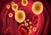 Having a lot of fat in the blood is more dangerous than we think
