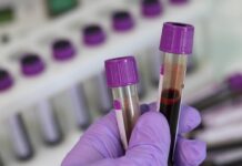 Diets based on blood group