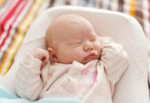 What are "port wine" stains in babies?