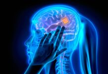 Synchron begins human testing of its brain implant