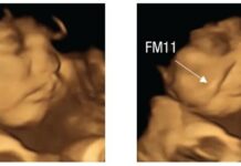 Babies react to tastes in the womb: they smile with the carrot and cry with the cabbage