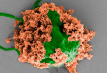 Tiny robots manage to remove pneumonia from the lungs of mice