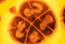 This bacterium could still survive under the soil of Mars
